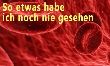 Impfschäden