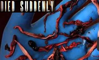 Suddenly